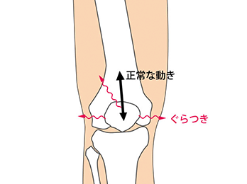 knee-img1-1