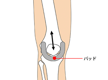knee-img1-2