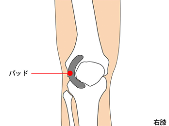 knee-img2-2