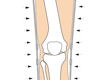 knee-img3-2